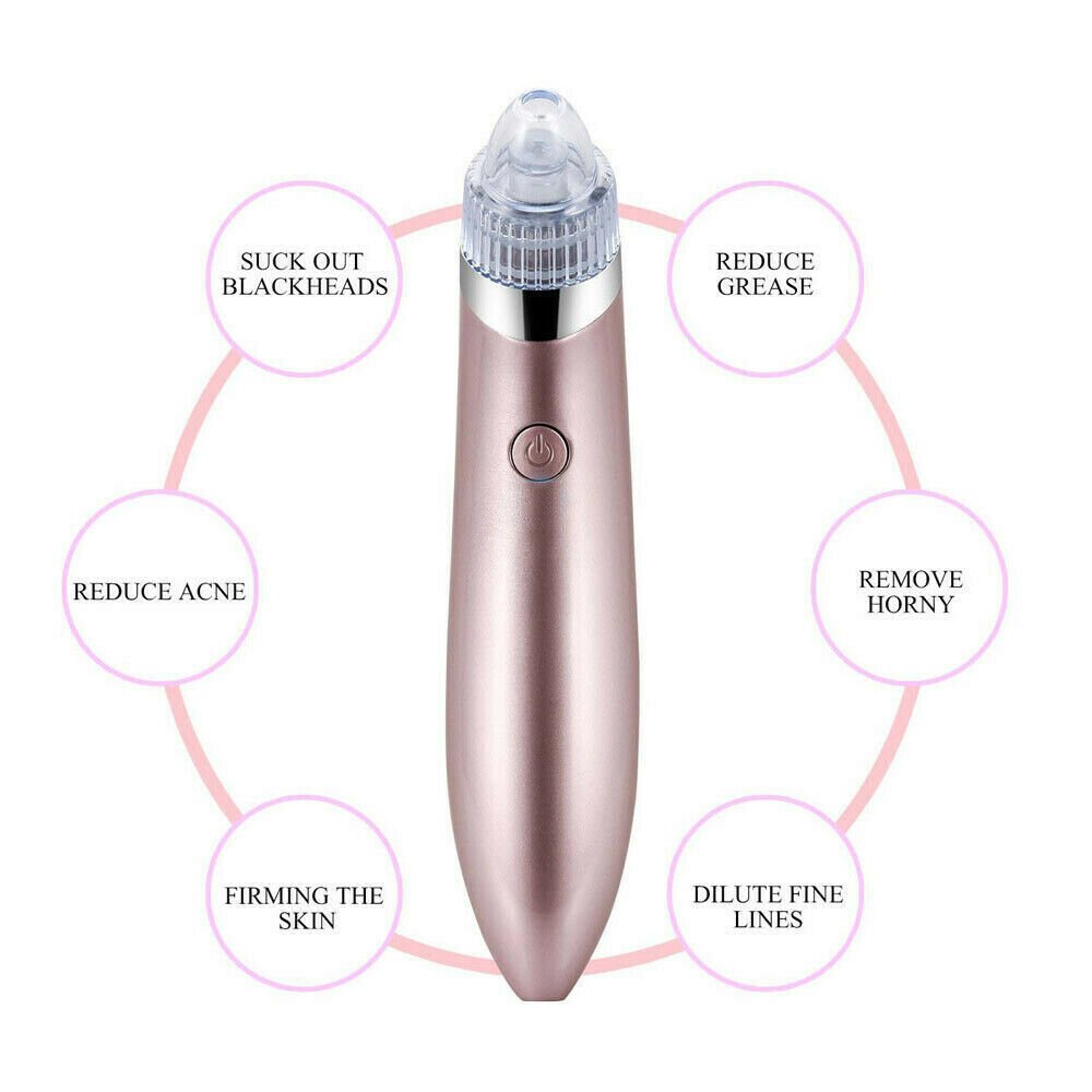 Electric Blackhead Vacuum Remover - Treasure Mementos