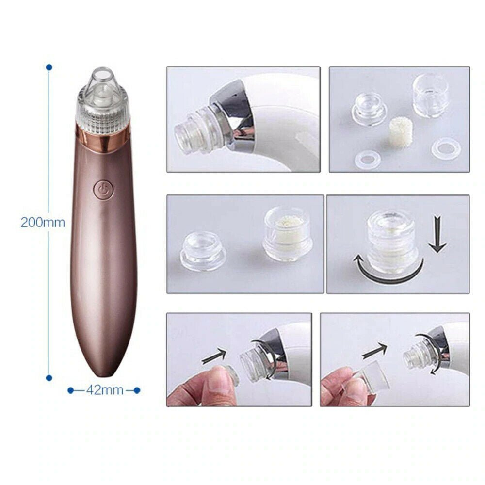 Electric Blackhead Vacuum Remover - Treasure Mementos
